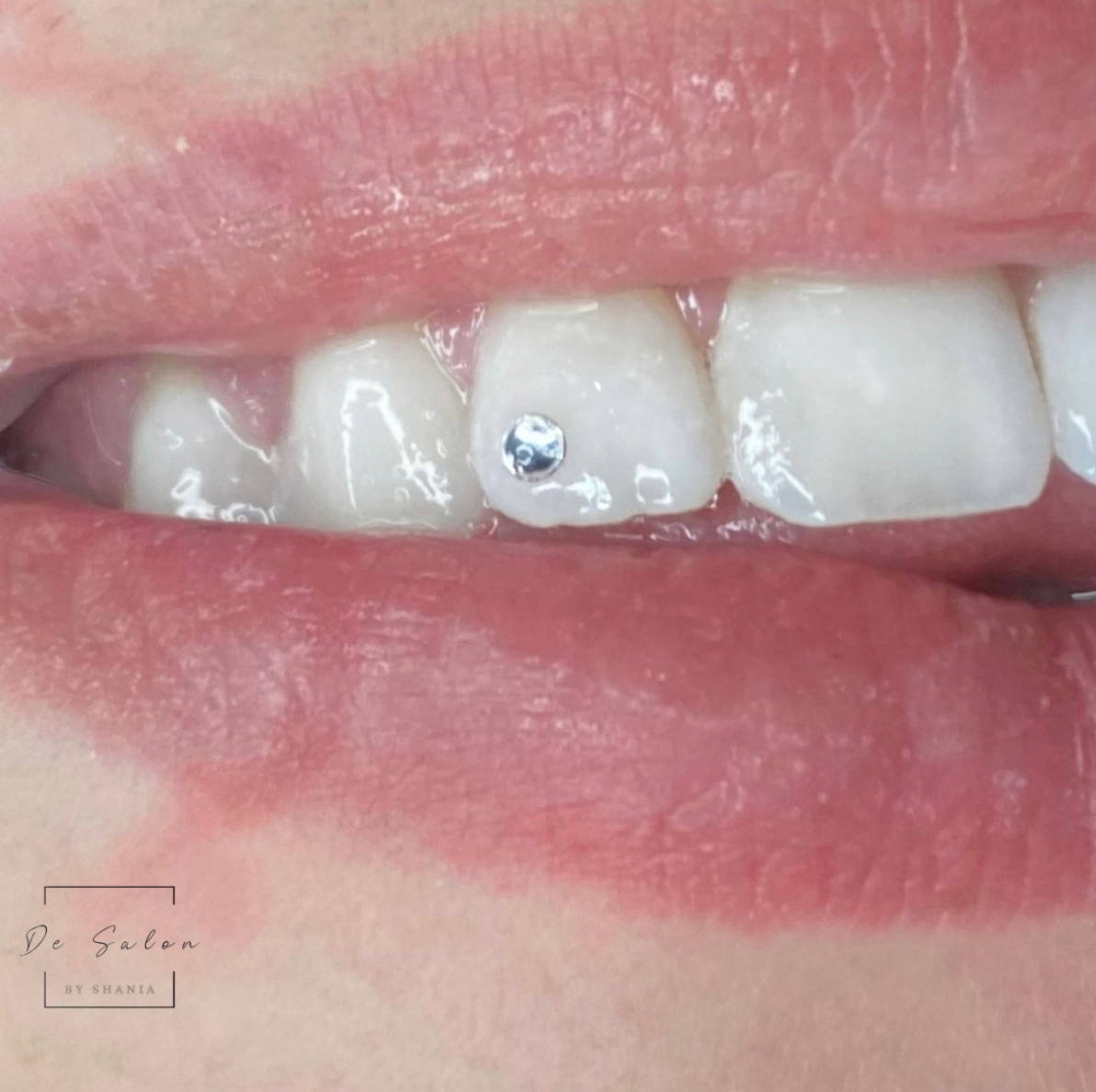 Glimlach met een Swarovski tandkristal op een voortand